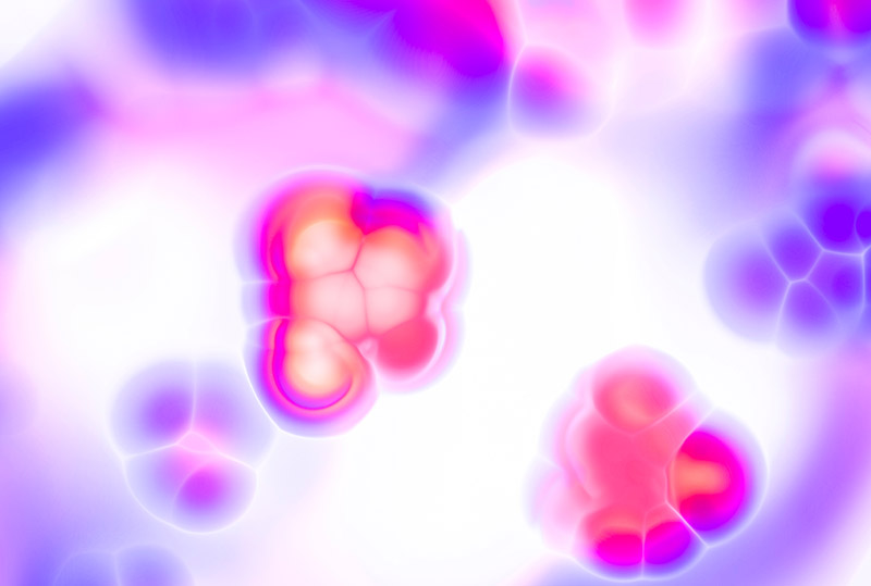 tumori tessuto nervoso